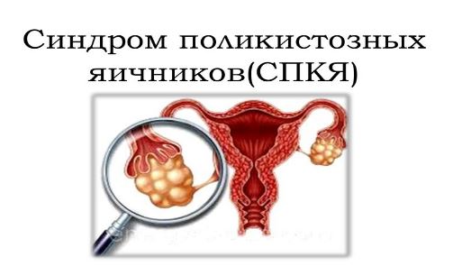паническая атака